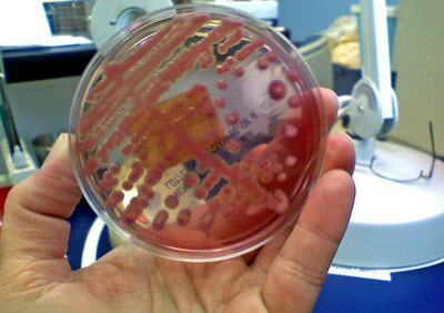 Бактерия Клебсиелла